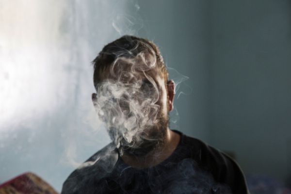 With slightly showing his artificial left eye, Danish Raja Jhat, 24 year old innocent victim of pellet bullets by India's Kashmir strategy, smokes during the rehabilitation workshop for visually impaired people, in a suburb of Srinagar.
