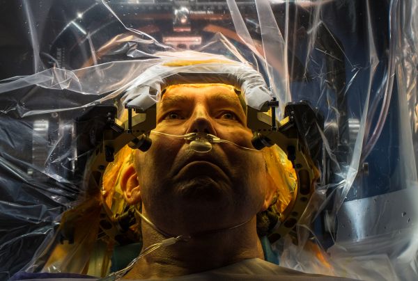 Deep brain stimulation (DBS) is a surgical procedure used to treat a variety of disabling neurological symptoms—most commonly the debilitating symptoms of Parkinson’s disease (PD), such as tremor, rigidity, stiffness, slowed movement, and walking problems.